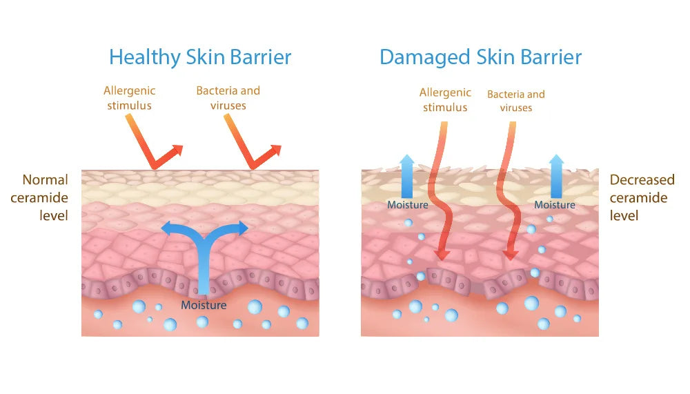 Understanding your Skin Barrier