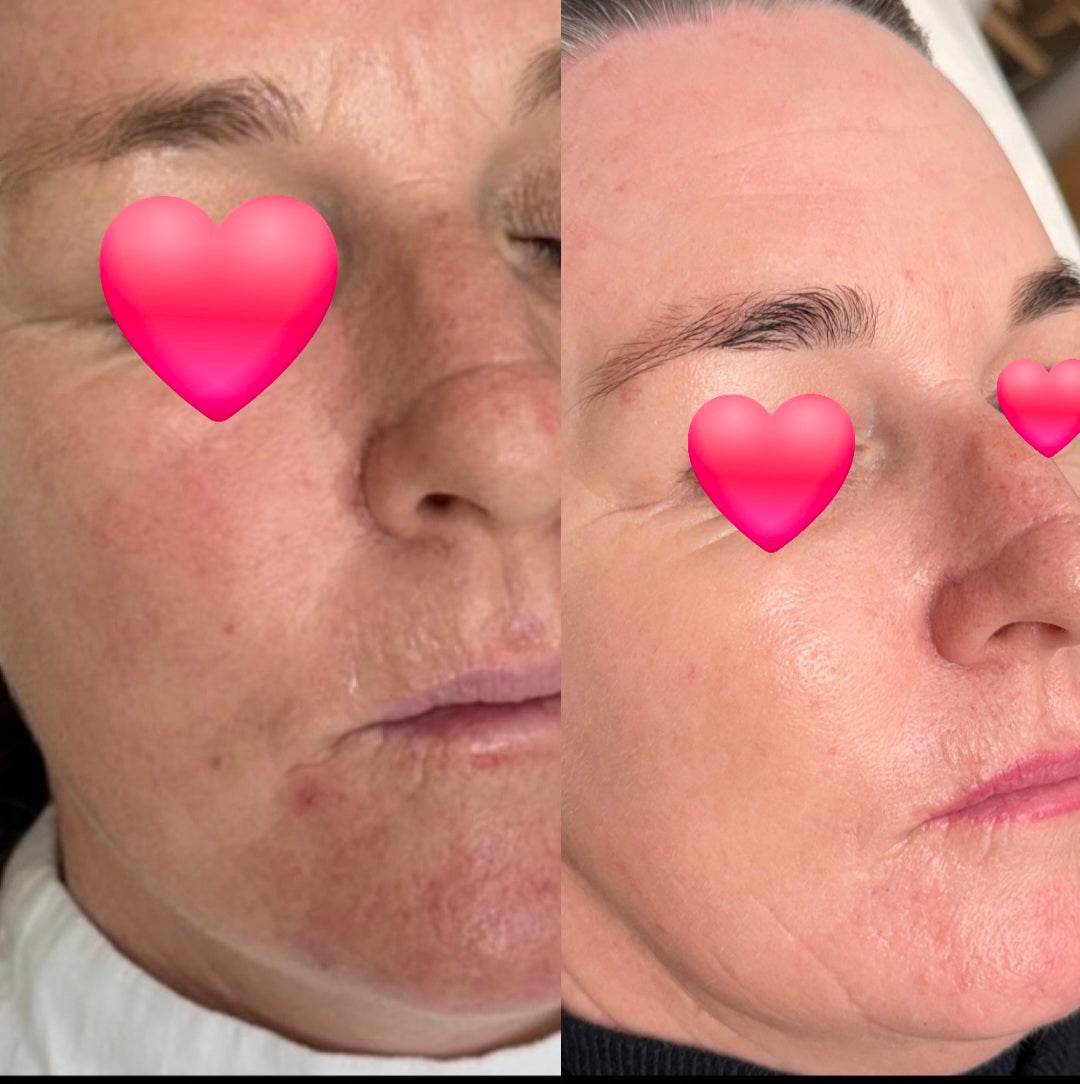 How do I know what to use on my skin?!